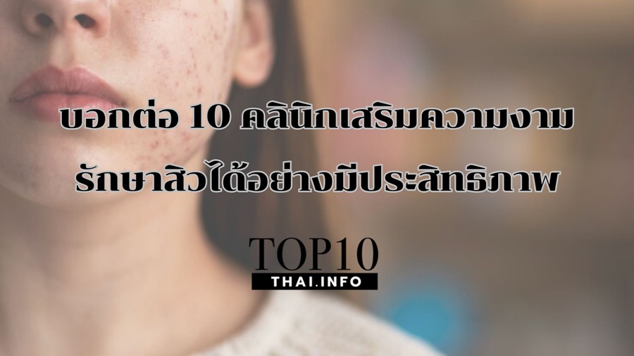 บอกต่อ 10 คลินิกเสริมความงาม รักษาสิวได้อย่างมีประสิทธิภาพ