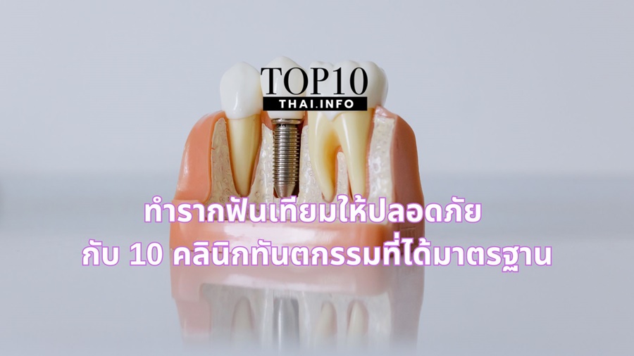 ทำรากฟันเทียมให้ปลอดภัย กับ 10 คลินิกทันตกรรมที่ได้มาตรฐาน